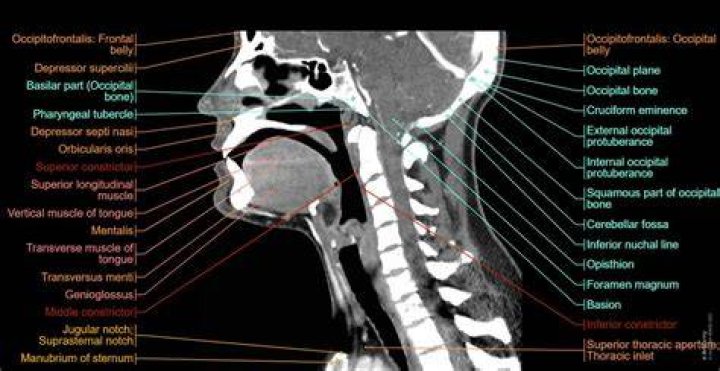 Are neck CT scans safe?