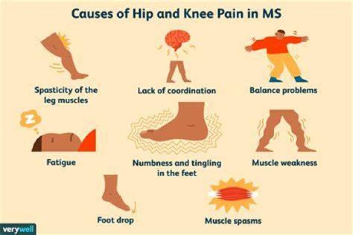 Are sore knees a symptom of MS?