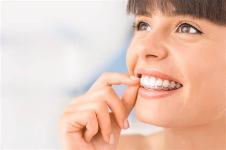 Can braces make your smile wider?