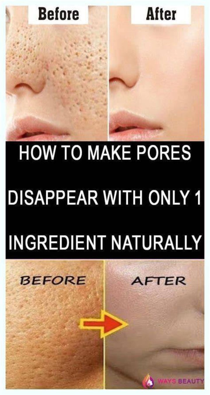 Can Colgate remove pores on face?
