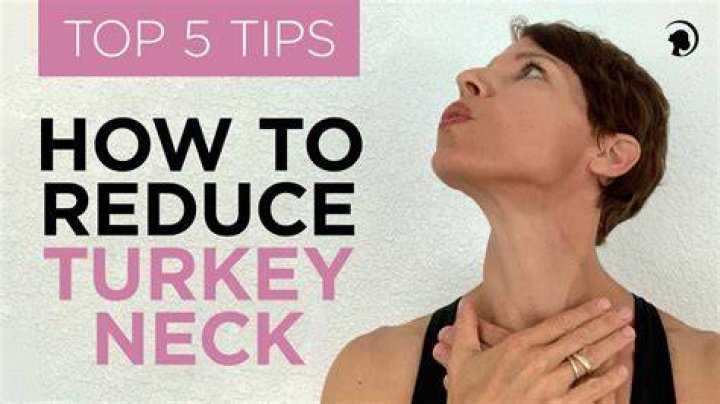 Can exercise get rid of turkey neck?
