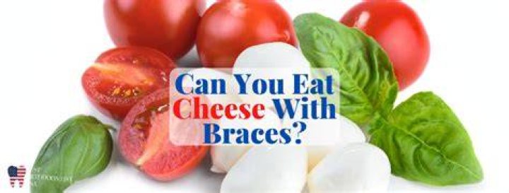 Can I eat cheese with braces?