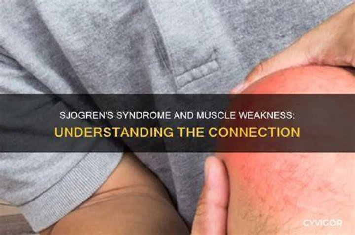 Can Sjogren's cause leg weakness?