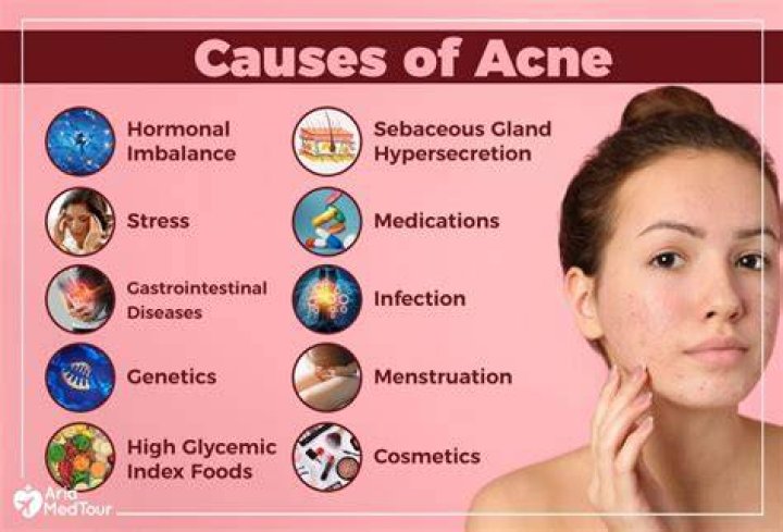 Does Coldwater cause acne?