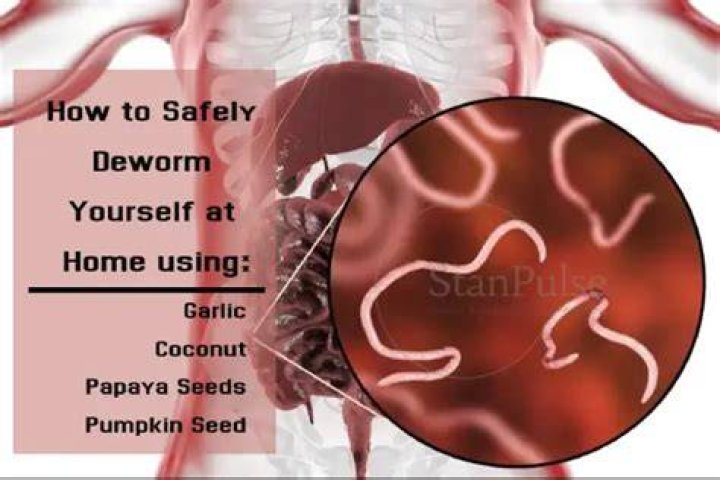 How can I Deworm naturally?