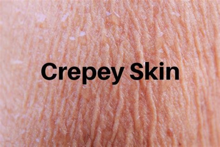 How do I fix Crepey skin on my face?