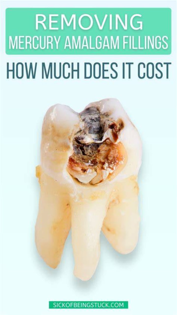 How do you detox from mercury fillings?