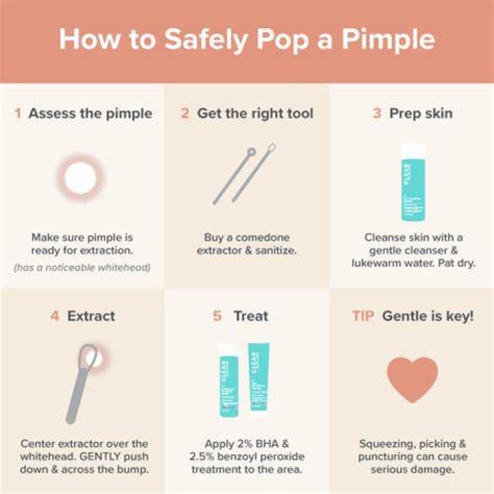 How do you pop a pimple with a pin?