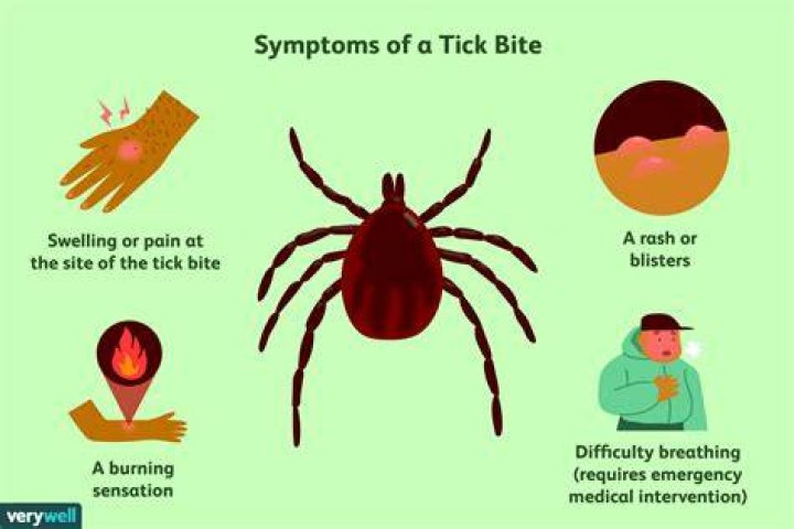 How do you treat a deer tick bite?