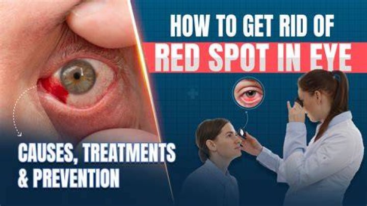 How fast is a red eye?