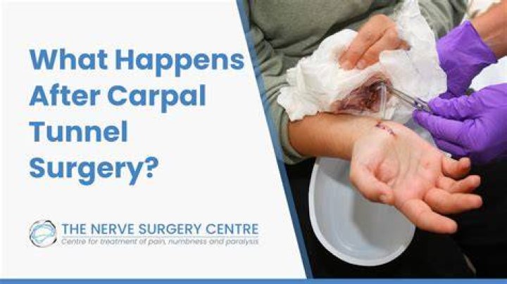 How long are fingers numb after carpal tunnel surgery?