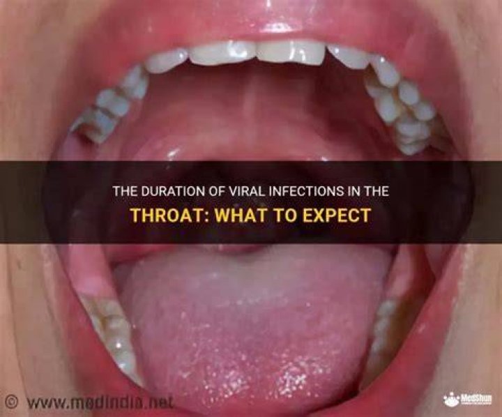 How long can a throat virus last?