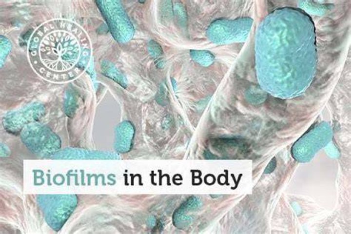 What are biofilms in your body?