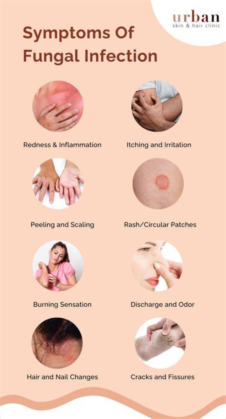 What are symptoms of fungus in the body?