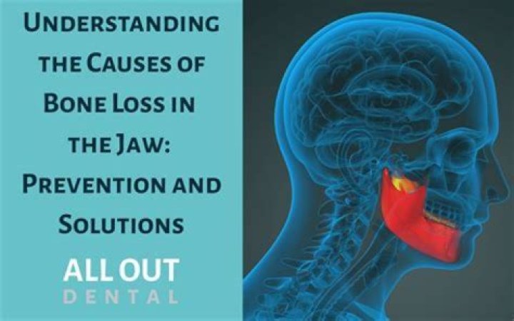 What does bone loss in jaw feel like?