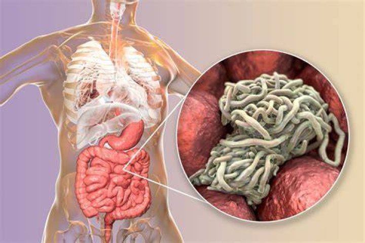 What does having pinworms feel like?