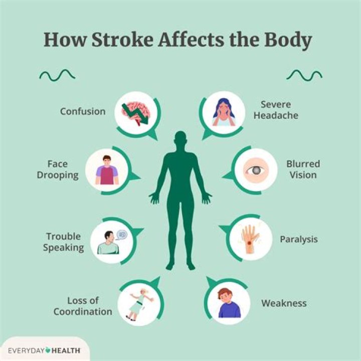 What if I had a stroke and didn't know?