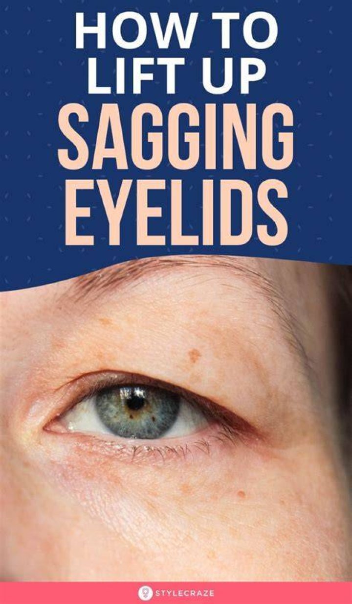 What is the best treatment for saggy eyelids?
