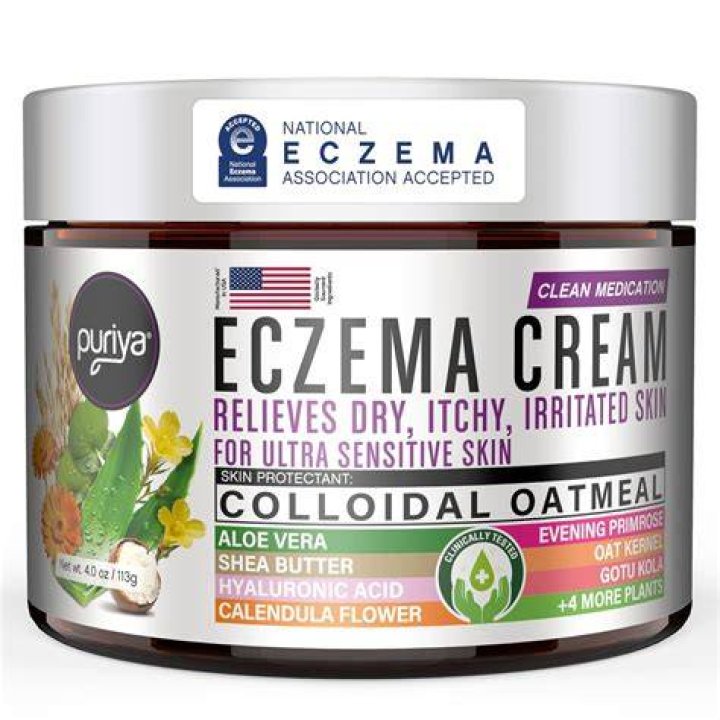 What kind of lotion is good for eczema?