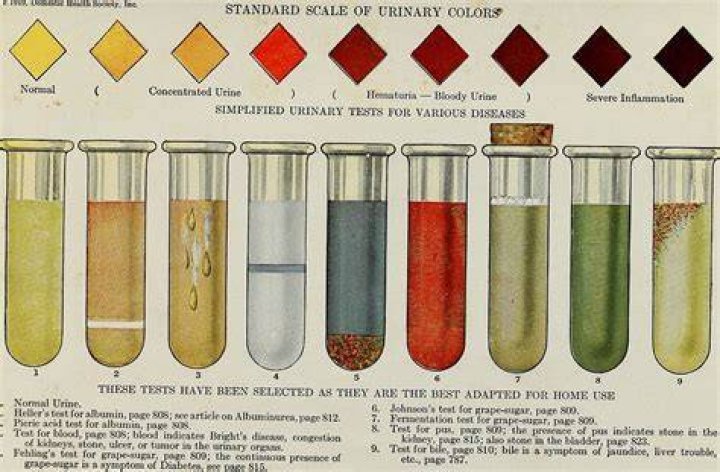 When did doctors taste urine for diabetes?