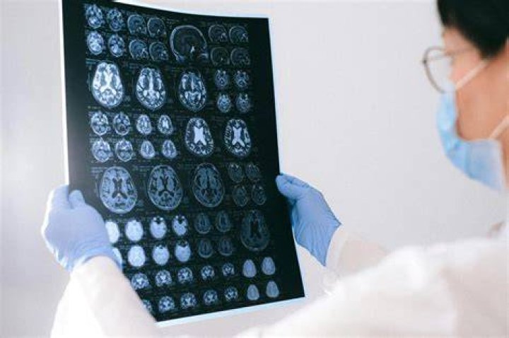 When should I see a neurologist?