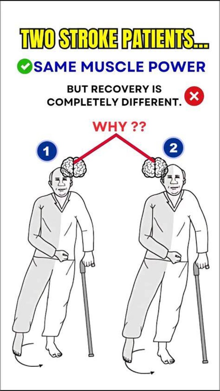 Will you ever be the same after a stroke?